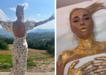 Anamaria Prodan și-a șters tatuajul cu Reghecampf! Frumoasa divă i-a șters până și pe copii!