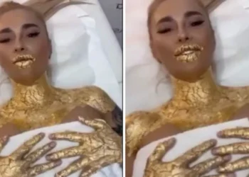 Diva Anamaria Prodan acoperită din cap până în picioare cu aur de 24k! Imagini uimitoare din timpul tratamentului, pe care nu mulți vi-l permiteți